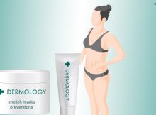 Dermology Stretch Mark Cream