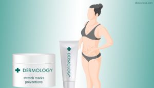 Dermology Stretch Mark Cream