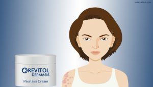 Revitol Dermasis Psoriasis Cream