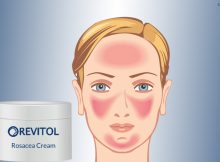 Revitol Rosacea Cream