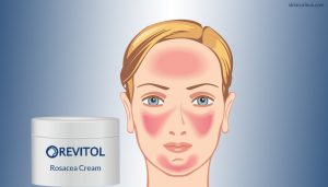 Revitol Rosacea Cream