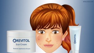 Revitol Scar Removal Cream